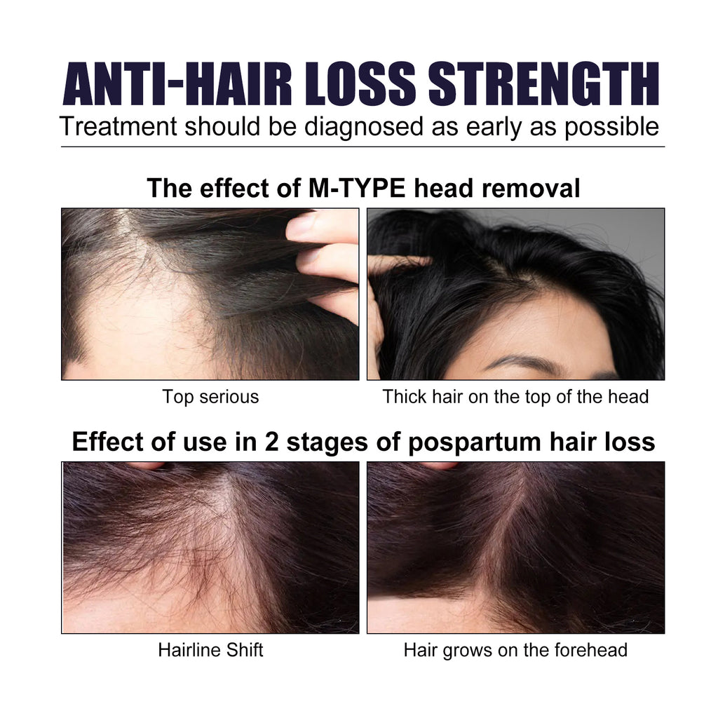 Hair Dense Herbal Spray, Nourishes Hair Prevents Hair Loss Strengthens And Thickens Hair Spray