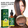 Dense Hair Essential Oil, Smooth Hair Repair Hair Root Thickening And Strengthening Hair Essence